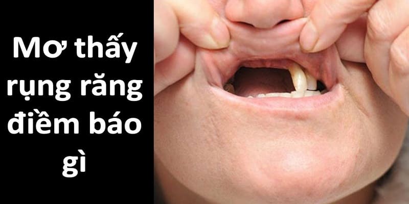 Mơ Thấy Rụng Răng Nên Lựa Chọn Số Nào Để Chơi