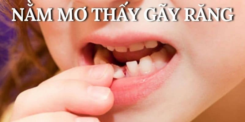 Mơ Thấy Gãy Răng Gợi Mở Điều Gì Về Tương Lai